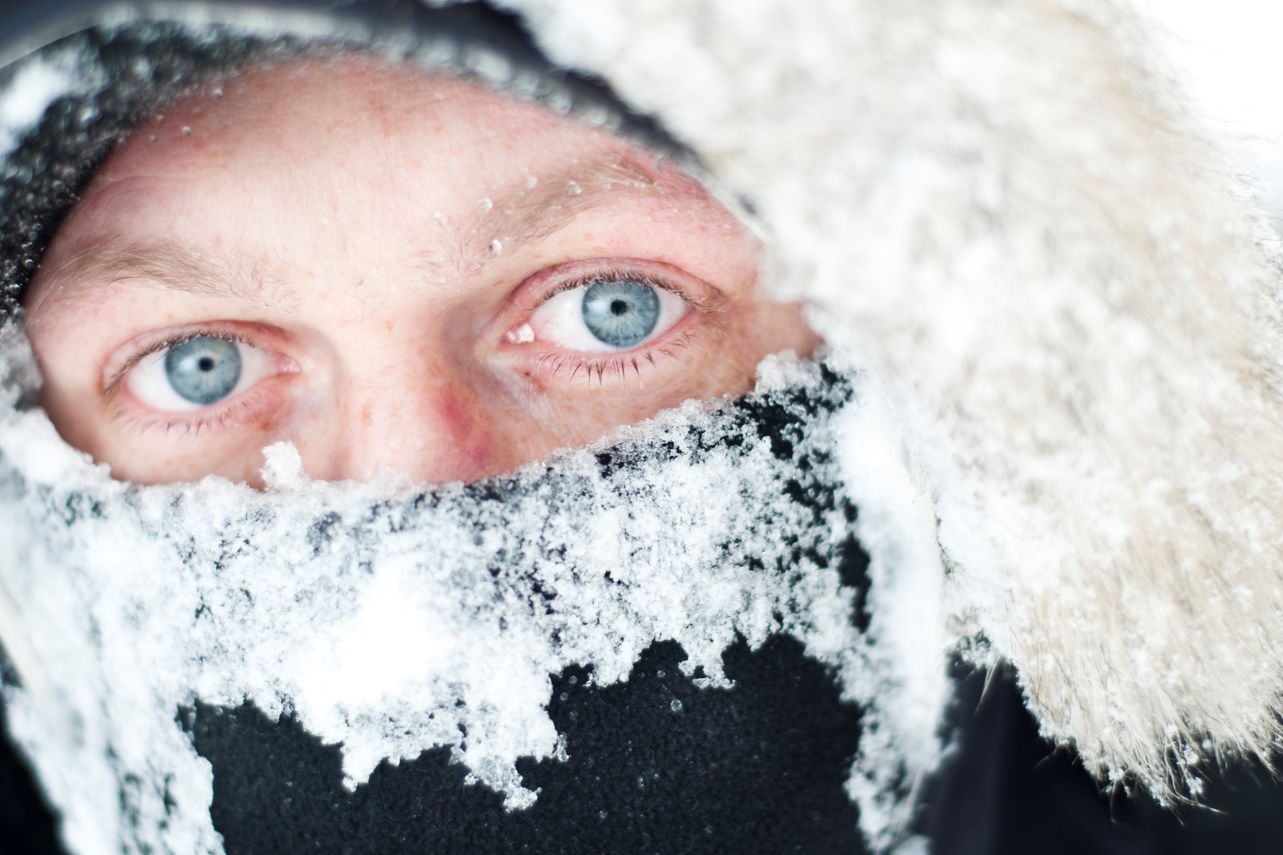 This cold. Обморожение и отморожение. Снег страх.